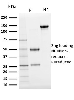 Data from SDS-PAGE analysis of Anti-Ubiquitin antibody (Clone UBB/2122). Reducing lane (R) shows heavy and light chain fragments. NR lane shows intact antibody with expected MW of approximately 150 kDa. The data are consistent with a high purity, intact mAb.